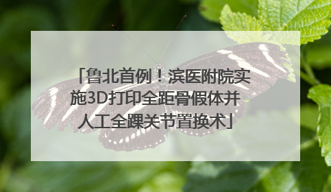 鲁北首例！滨医附院实施3D打印全距骨假体并人工全踝关节置换术